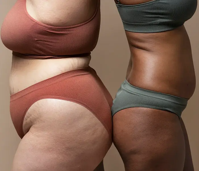 Body Slimming 1 Body slimming and skin Smoothing